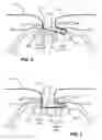 Fig. 06 - APPARATUS AND METHOD FOR SCREEN TENSIONING