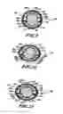 Fig. 08 - Transmission and variable radially expanding spring clutch assembly