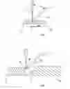 Fig. 02 - WELDING METHOD COMBINING A LASER BEAM AND THE ELECTRIC ARC WITH A CONSUMABLE ELECTRODE FOR ASSEMBLING ABUTTING METAL CONDUITS TO FORM PIPELINE METAL PIPES