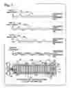 Fig. 04 - Compensating for position errors in displacement transducers