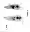 Fig. 45 - Mechanism-Based Targeted Pancreatic Beta Cell Imaging and Therapy