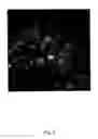 Fig. 03 - CARDIOMYOCYTE-LIKE CELL CLUSTERS DERIVED FROM HBS CELLS