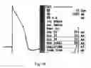 Fig. 69 - CARDIOMYOCYTE-LIKE CELL CLUSTERS DERIVED FROM HBS CELLS