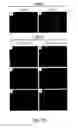Fig. 76 - CARDIOMYOCYTE-LIKE CELL CLUSTERS DERIVED FROM HBS CELLS