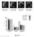 Fig. 22 - CD36 MODULATION AND USES THEREOF