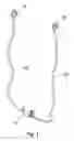 Fig. 02 - Apparatus and method for treating female urinary incontinence