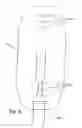 Fig. 04 - Apparatus and method for treating female urinary incontinence