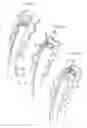 Fig. 05 - SYSTEMS AND METHODS FOR ENDOSCOPIC INVERSION AND REMOVAL OF DIVERTICULA