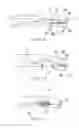 Fig. 09 - SYSTEMS AND METHODS FOR ENDOSCOPIC INVERSION AND REMOVAL OF DIVERTICULA