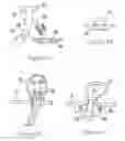 Fig. 12 - SYSTEMS AND METHODS FOR ENDOSCOPIC INVERSION AND REMOVAL OF DIVERTICULA