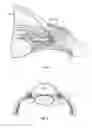 Fig. 02 - Ocular implant delivery systems and methods
