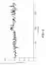 Fig. 03 - Method and apparatus for non-invasively estimating body core temperature
