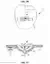 Fig. 10 - Method and implantable system for blood-glucose concentration monitoring using parallel methodologies