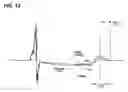 Fig. 15 - Method and implantable system for blood-glucose concentration monitoring using parallel methodologies