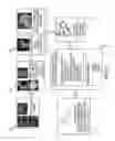 Fig. 03 - Method and system for multi-component heart and aorta modeling for decision support in cardiac disease