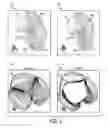 Fig. 06 - Method and system for multi-component heart and aorta modeling for decision support in cardiac disease