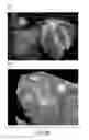 Fig. 08 - Method and system for multi-component heart and aorta modeling for decision support in cardiac disease