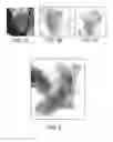 Fig. 09 - Method and system for multi-component heart and aorta modeling for decision support in cardiac disease