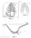 Fig. 04 - SYSTEM AND METHOD TO CHARACTERIZE CARDIAC FUNCTION
