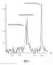 Fig. 02 - SINGLE BREATH-HOLD SYSTEM AND METHOD FOR DETECTION AND ASSESSMENT OF MULTI-ORGAN PHYSIOLOGIC, MORPHOLOGIC AND STRUCTURAL CHANGES