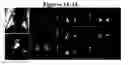 Fig. 04 - SINGLE BREATH-HOLD SYSTEM AND METHOD FOR DETECTION AND ASSESSMENT OF MULTI-ORGAN PHYSIOLOGIC, MORPHOLOGIC AND STRUCTURAL CHANGES