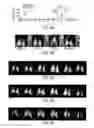Fig. 07 - SINGLE BREATH-HOLD SYSTEM AND METHOD FOR DETECTION AND ASSESSMENT OF MULTI-ORGAN PHYSIOLOGIC, MORPHOLOGIC AND STRUCTURAL CHANGES