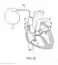 Fig. 13 - CONTINUOUS FIELD TOMOGRAPHY SYSTEMS AND METHODS OF USING THE SAME