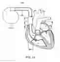 Fig. 14 - CONTINUOUS FIELD TOMOGRAPHY SYSTEMS AND METHODS OF USING THE SAME