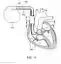 Fig. 15 - CONTINUOUS FIELD TOMOGRAPHY SYSTEMS AND METHODS OF USING THE SAME