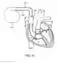 Fig. 16 - CONTINUOUS FIELD TOMOGRAPHY SYSTEMS AND METHODS OF USING THE SAME