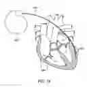 Fig. 17 - CONTINUOUS FIELD TOMOGRAPHY SYSTEMS AND METHODS OF USING THE SAME