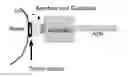 Fig. 01 - Direct visualization robotic intra-operative radiation therapy applicator device
