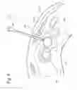 Fig. 07 - FINE NEEDLE BIOPSY SYSTEM AND METHOD OF USE
