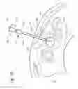 Fig. 08 - FINE NEEDLE BIOPSY SYSTEM AND METHOD OF USE