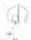 Fig. 04 - Therapy system including multiple posture sensors
