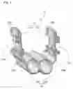 Fig. 05 - MUSCLE FORCE ASSISTING DEVICE