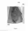 Fig. 02 - MEDICAL DEVICE FOR SHRINKING OPEN WOUNDS