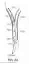 Fig. 06 - Methods and systems for establishing retrograde carotid arterial blood flow