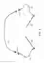 Fig. 09 - Methods and systems for establishing retrograde carotid arterial blood flow