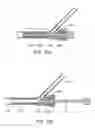 Fig. 22 - Methods and systems for establishing retrograde carotid arterial blood flow
