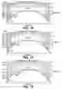 Fig. 08 - Apparatus for reducing contamination of surgical site
