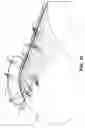 Fig. 22 - Apparatus for reducing contamination of surgical site