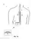 Fig. 02 - Posture-responsive therapy control based on patient input