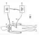 Fig. 02 - Relay device for transferring information between a sensor system and a fluid delivery system