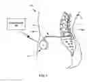 Fig. 02 - Medical pump with fixed stroke length
