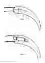 Fig. 02 - Catheter apparatus