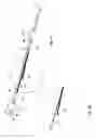 Fig. 14 - Occlusion perfusion catheter