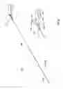 Fig. 15 - Occlusion perfusion catheter
