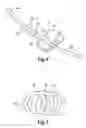 Fig. 04 - Medical Tube Support and Method of Use of Same