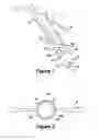 Fig. 02 - Intrauterine system